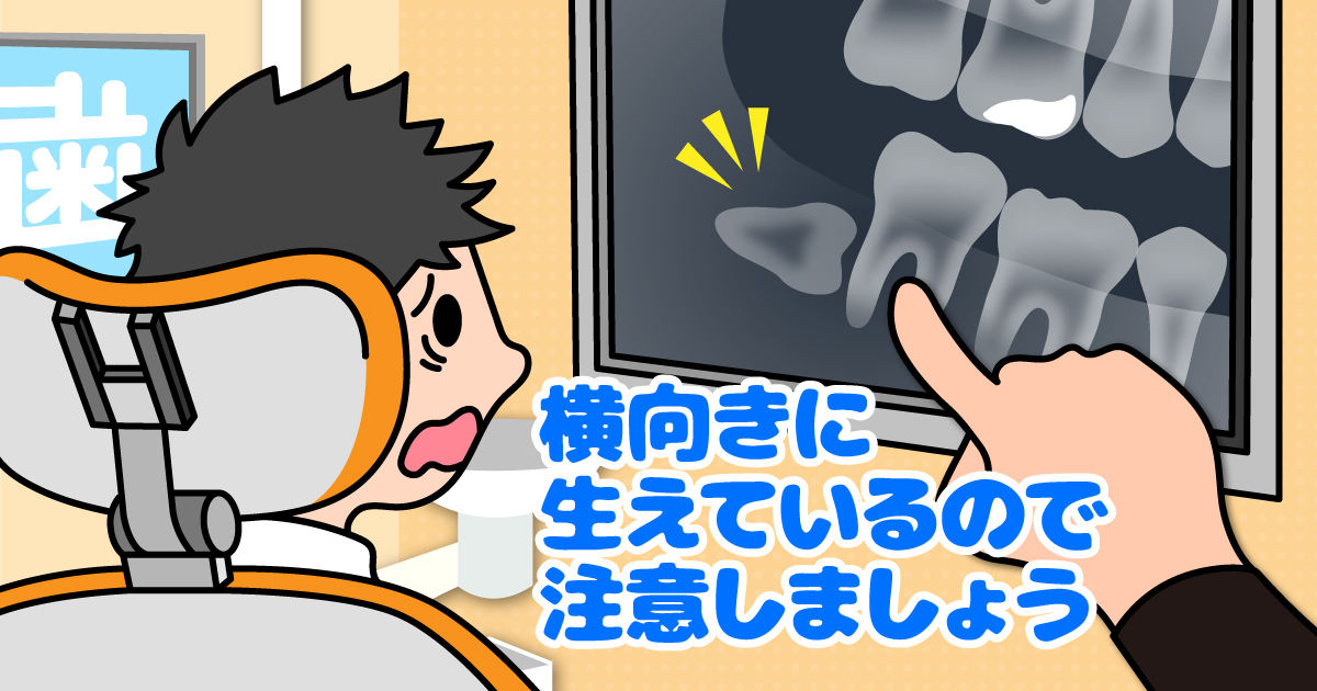 太白区・長町の無症状でも油断禁物!? レントゲンで発見される隠れた病気