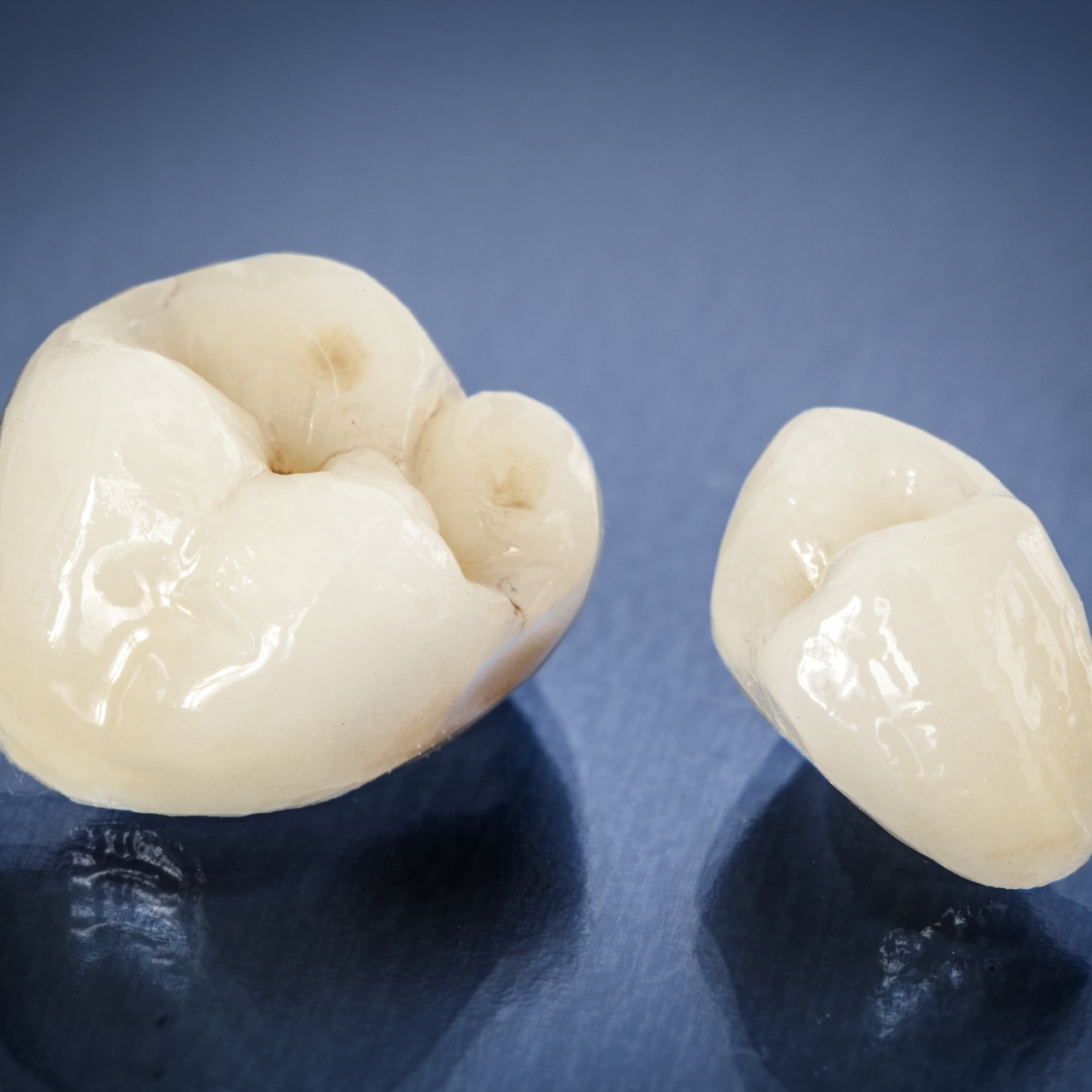 太白区・長町の全顎治療(フルマウス治療)