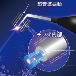 太白区・長町「あすと長町歯科」の最新の歯周病治療「ブルーラジカルP-01」