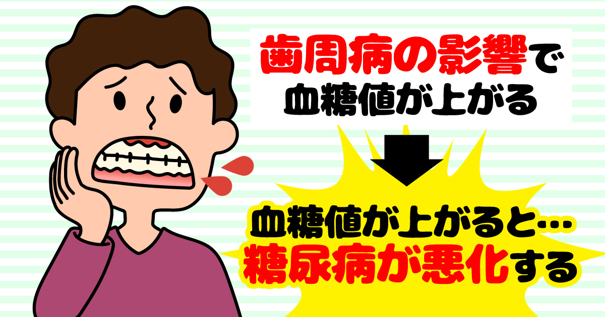 太白区・長町の歯周病治療で糖尿病が改善!?その理由とは