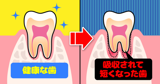 太白区・長町の無症状でも油断禁物!? レントゲンで発見される隠れた病気