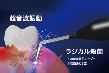 最新歯周病学 新版 最新歯周病学／医歯薬出版株式会社