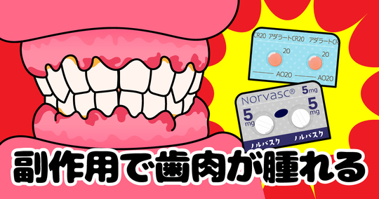 太白区・長町の高血圧とお口の意外な関係！知られざるリスクとは？
